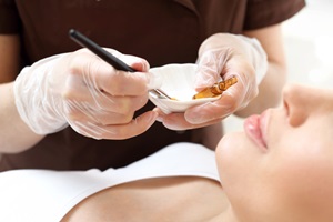woman having a chemical peel done