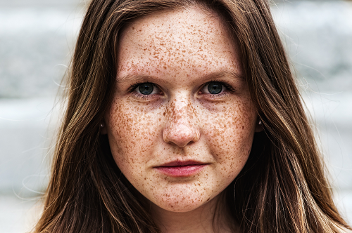woman with freckles on her face