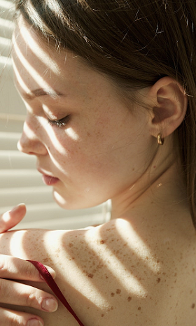 woman with freckles on her back