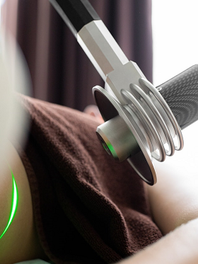 laser machine for asshole whitening