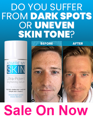 Admire My Skin Dark Spot Remover