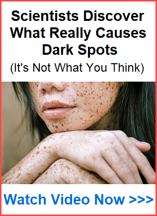 BioRestore Complete Video and woman with dark spots