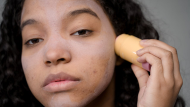 woman applying an acne skincare product to her face